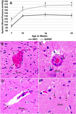 Characterizing CD38 Expression and Enzymatic Activity in the Brain of Spontaneously Hypertensive Stroke-Prone Rats